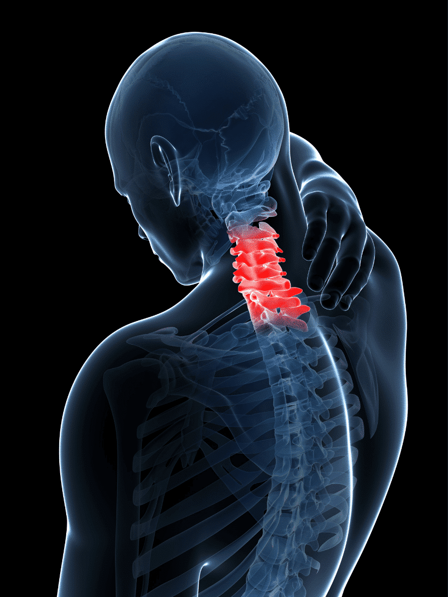 https://www.injuredcalltoday.com/wp-content/uploads/2019/08/Where-to-Put-TENS-Pads-for-Neck-Pain.png