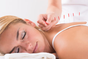 Acupuncture After an Auto Accident Injury