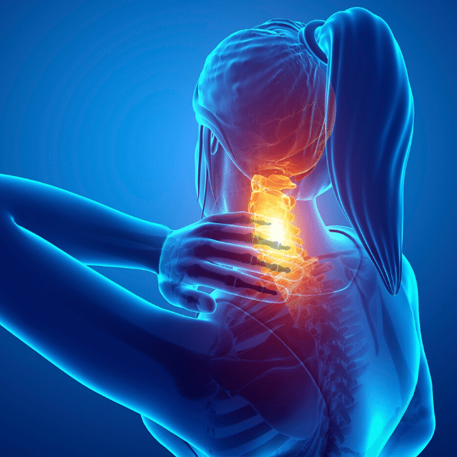 Best Treatment For Cervical Radiculopathy After a Car Accident