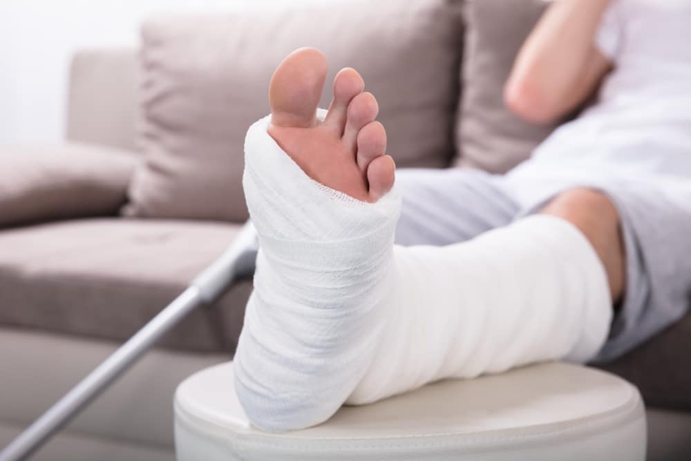 Broken Bones and Fractures