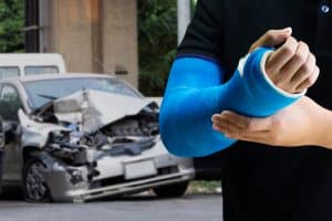 Car Accident Fractures